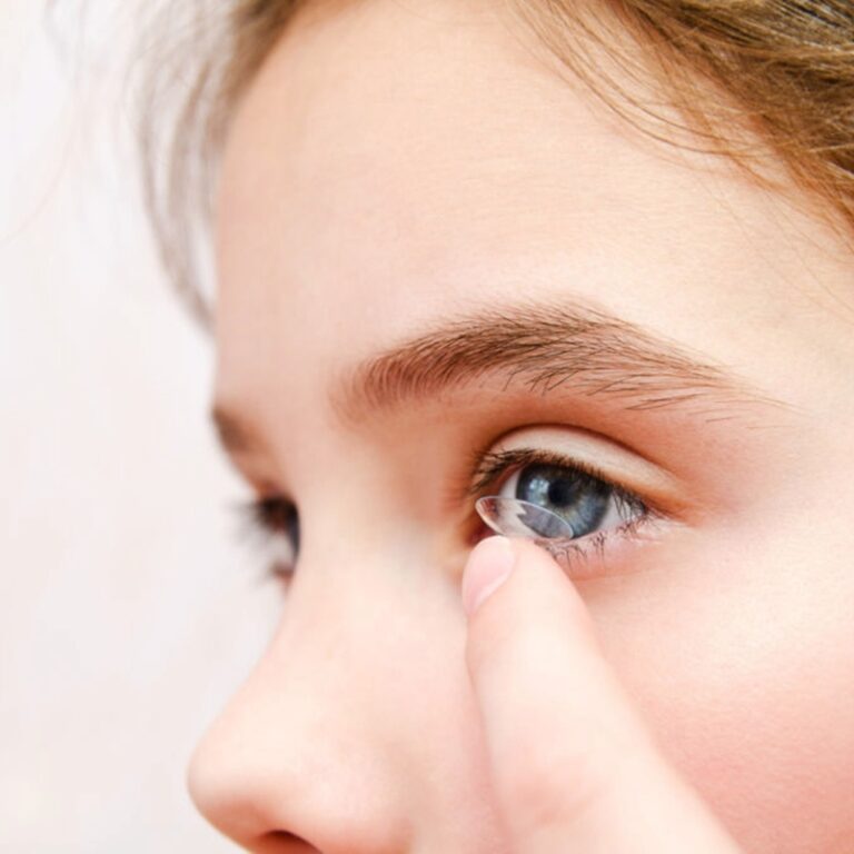 MiSight - soczewki kontaktowe do kontroli krótkowzroczności Salon Optyczny Lepiej Widzę w Radomsku